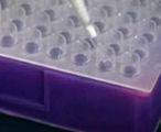 PCR in the laboratory