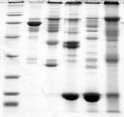 Protein Electrophoresis