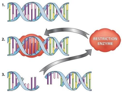 Restriction enzyme